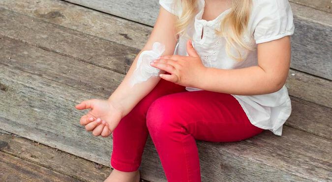 Cuales son los síntomas del eczema